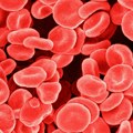 Novi tretman smanjuje širenje raka krvi za 74 odsto