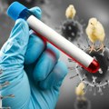 Ptičiji grip otkriven kod krava u Americi, virus se nalazi i u njihovom mleku: Ovako su otkrili da su zaražene