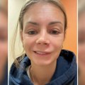 Završila u bolnici zbog bubuljice u "trouglu smrti": Devojci se paralizovao deo lica, mogla je da prođe mnogo gore