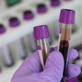 Razvijena nova metoda za dijagnostikovanje bolesti materice pomoću analiza krvi