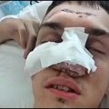 Узменирујући снимци: Вучићеви батинаши брутално претукли студента па га везали за кревет (ФОТО)