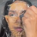 Marija Mikić ponovo operisana zbog komplikacija sa glasnim žicama