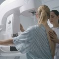 Besplatni mamografski pregledi u Domu zdravlja Novi Sad tokom maja