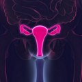 Suvoća vagine: Jeste problem, orošavanje nije rešenje