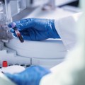Beč: Razvijen prvi test za rano otkrivanje multiple skleroze