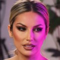 Rada Manojlović ne može više da ćuti! Otkrila svu istinu o plastičnim operacijama (foto)