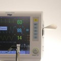 Dvogodišnji dečak koji je zadobio opekotine na 60 odsto tela i dalje u teškom stanju