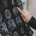 Naučnici: Litijum bi mogao igrati ključnu ulogu u lečenju Alchajmerove bolesti