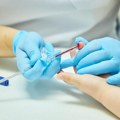 Akcije dobrovoljnog davanja krvi danas na više mesta: Poziv humanim građanima, Institut radi svakodnevno