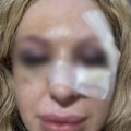Članovima obezbeđenja određen pritvor: Saslušani zbog brutalnog prebijanja žene i njenog muža u kafani u Beogradu: Evo…