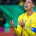 Ronaldo objavio fotografiju svojih nogu, navijači se zaprepastili kad su videli kako mu izgledaju prsti