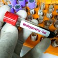 U Severnoj Makedoniji prvi put potvrđena dva slučaja majmunskih boginja