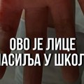 Nasilje u vlasotinačkoj školi: Dečak iz škole izašao sam i krvav, primetili ga ljudi na stanici
