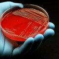 Zdravlje: Da li se antibioticima uništavaju i neophodne bakterije u ljudskim crevima