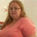 Imala je 150 kilograma, a onda je odlučila da stavi tačku na sve: Podvrgla se zahvatu zbog kog je izgubila 90 kilograma