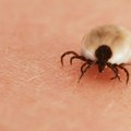 Prvi slučaj alfa-gal sindroma potvrđen u Srbiji, a krivci su krpelji
