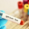 Signali organizma da treba proveriti IgM antitela: Visok ili nizak nivo često prvi signal opasnih infekcija