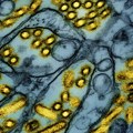 U Australiji registrovan drugi slučaj smrtonosnog ptičjeg gripa H5N1