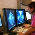 Vještačka inteligencija olakšava otkrivanje raka dojke