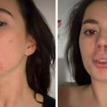 Језиве фотографије претучене задругарке - лице у подливима, око полузатворено: Огласила се усред ноћи