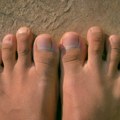 U staroj Grčkoj je imalo posebno značenje: Zašto je nekima drugi prst na stopalu duži od palca?