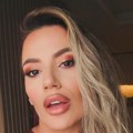 "Ljudi misle da sam poremećena" Žena Kristijana Golubovića izašla ovako na ulicu, prolaznici u neverici! (foto)