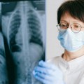 Revolucija u medicini: Injekcija koja "briše" tumore čak i kada hemoterapija zakaže