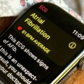 Apple Watch će biti povezan sa 5G