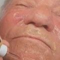 ''Izašao sam kao nov čovek'' Viralan snimak Miloša Bojanića na tretmanu podmlađivanja, mreže se usijale (video)