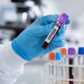 Virus Zapadnog Nila se širi Grčkom: Atika najveće žarište, desetine obolelih