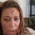 "Izubijana sam, ide mi krv sa svih strana, prebio me je, molim vas zovite hitnu pomoć" Ana Nikolić unakažena od batina…
