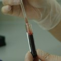 Jedan uzorak krvi mogao bi da otkrije biološku starost svakog vašeg organa