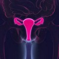 ‘Nevidljivi invaliditet’: Šta je endometrioza i kako se leči na Balkanu