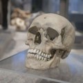 Ljudi danas imaju drugačije lobanje nego pre 100 godina: Naučnici otkrili iznenađujuće promene