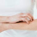 Grejna sezona donosi probleme sa kožom: Dermatolozi savetuju kako uda ublažite suvoću i svrab
