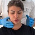 Miljana Kulić potpuno promenila izgled! Posetila estetičara pred Elitu 9, pa pokazala rezultate: "Otečena sam"