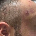 „Mračne tajne“ sada su otkrivene Prva ispovest žrtve policijskog nasilja u Banjaluci koja ostavlja bez daha
