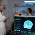 Radak: Moždani udar pokazuje simptome i sedam dana ranije, implementacija AI u medicini moguća na više načina