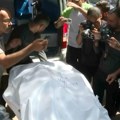 SZO: Umiraće ljudi ako ih ne evakuišu iz razorene bolnice u Gazi