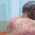Српска листа: Припадници косовске полиције претукли Ненада Рашковића код Зубиног Потока