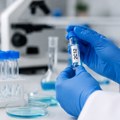 Kuba razvila novi preparat protiv melanoma: Počinju ispitivanja na ljudima