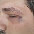 Kosjerić: Bivši policajac i član SNS-a udario i snimatelja i opozicionara