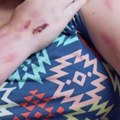 Ako vidite ovu biljku, jedno nikako ne radite! Izaziva plikove i jake opekotine, posebno je opasna za decu: Oglasili se…