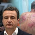 Експлозија Куртијевог притиска на Србе на Косову: Мучење и везивање за дрво, багери на Газиводама и рампа за српске тужиоце…