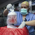 Први човек добио бубрег од генетски узгојене свиње: Подвиг хирурга у САД, пацијент ће ускоро бити пуштен из болнице