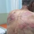 Srpska lista: Pripadnici kosovske policije pretukli muškarca u Drenu, vezali ga za drvo u šumi