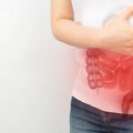 Ovo je najbolji redosled jedenja hrane za zdravlje creva: Gastroenterolozi ga preporučuju