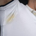 Kako jednostavno ukloniti žute mrlje sa odeće: U 2 koraka rešite se zauvek fleka, sve sastojke imate kod kuće