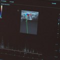 Ovog vikenda, u specijalističkim ambulantama, pregledi kardiologa, neurologa i gastroenterologa