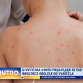 Vrtićka deca na udaru: "Prvo krene od lošeg opšteg stanja" VIDEO